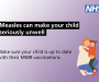 Walsall residents urged to check MMR status as measles cases rise in region